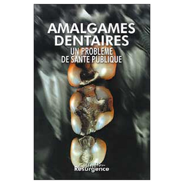 Amalgames dentaires