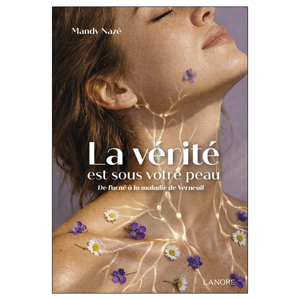 La vérité est sous votre peau - De l'acné à la maladie de Verneuil