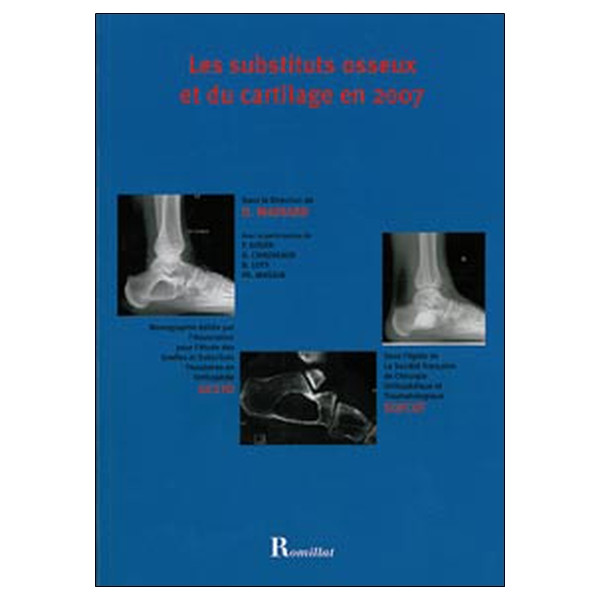 Substituts osseux et du cartilage en 2007
